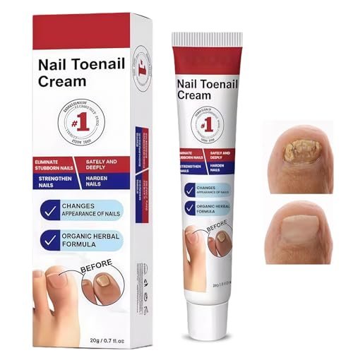 20g Crema per Riparazione Unghie, Cura Unghie Piedi, Soluzione per La Cura Delle Unghie, Rinforzante Unghie, Nail Repair per Restores Appearance of Discolored or Damaged Nails
